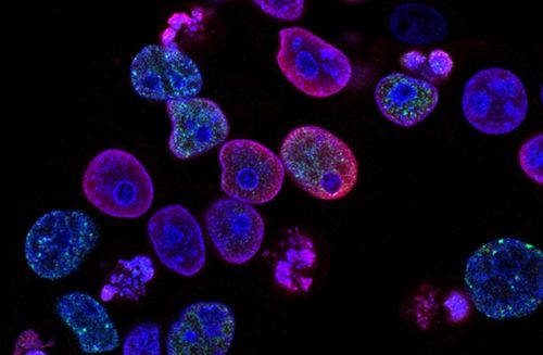 瑞士生物科技公司invasight利用突破性的細胞間蛋白靶點發(fā)現平臺,開發(fā)蛋白質 蛋白質相互作用抑制劑,靶向治療侵襲性癌癥 瑞士創(chuàng)新100強
